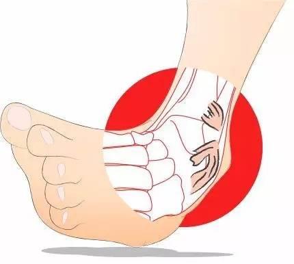 吃瓜崴脚了,意外事件中的生活小插曲